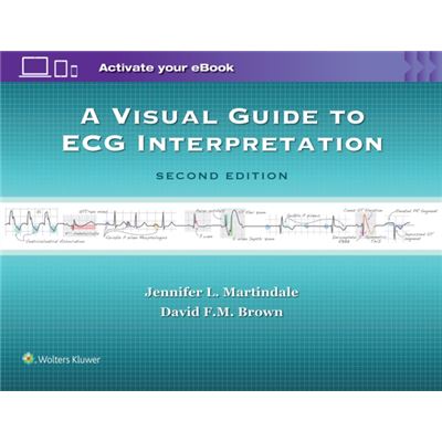 Visual Guide To Ecg Interpretation Broch Martindale Livre Tous