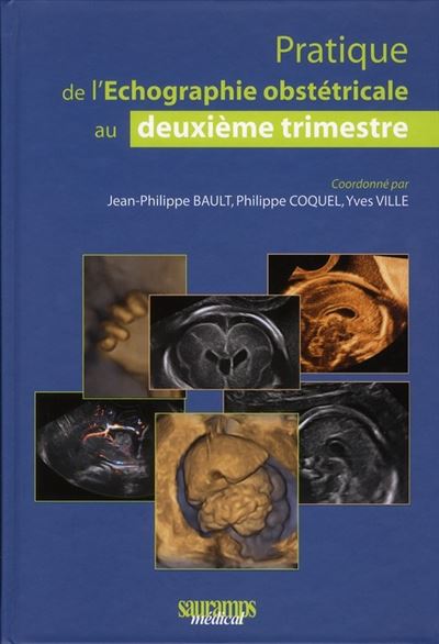 Pratique de l echographie obstetricale au 2e timestre 2e ed broché