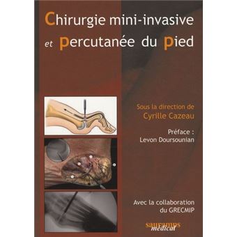 Chirurgie Mini Invasive Et Percutanee Du Pied Tome Broch