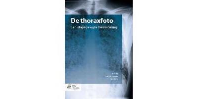 De thoraxfoto