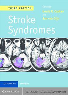 Stroke Syndromes - 1