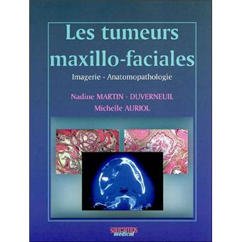 Les tumeurs maxillo-faciales