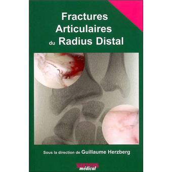 Fractures articulaires du radius distal