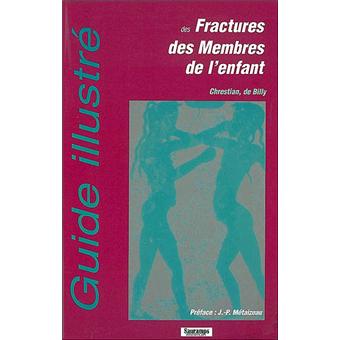 Guide illustre des fractures des membres de l enfant