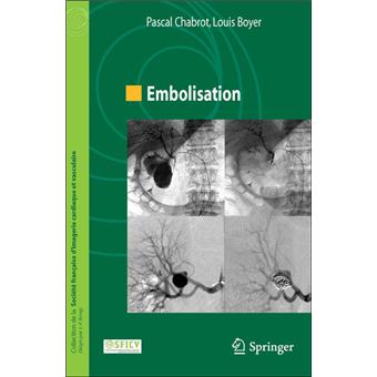 Embolisation