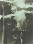 Robert flynt compound fracture