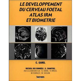 Developpement du cerveau foetal