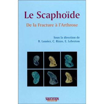 Le scaphoide