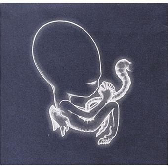 Sigur Rós - 1