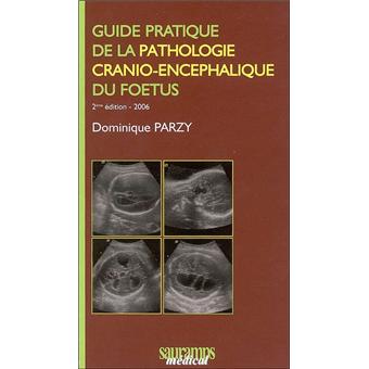 Guide pratique de la pathologie cranio encephalique