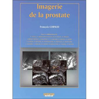 Imagerie de la prostate