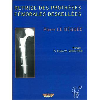 Reprises des protheses femorales descellees