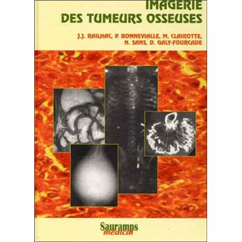Imagerie des tumeurs osseuses