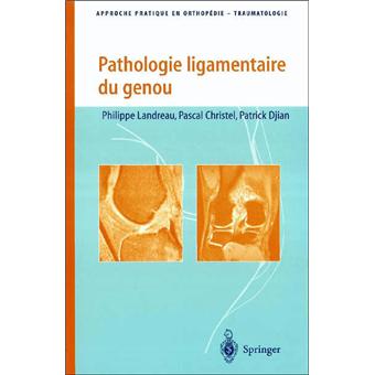 Pathologie ligamentaire du genou