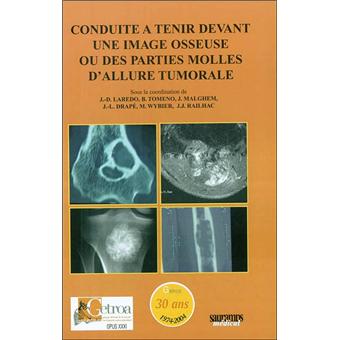 Conduite a tenir devant une image osseuse ou des parties molles d allure tumoral