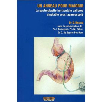 Un anneau pour maigrir