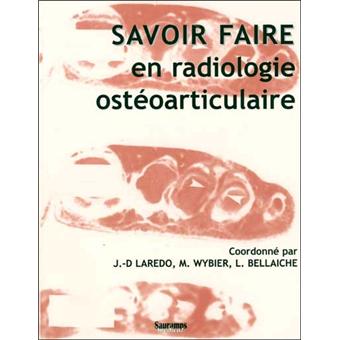 Savoir faire en radio osteo-radiculaire