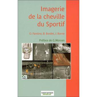 Imagerie de la cheville du sportif