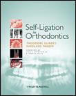 Self-ligation in orthodontics - 1