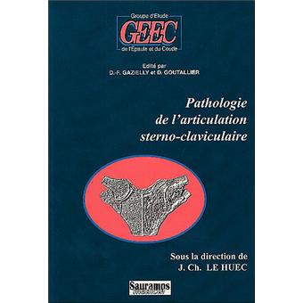 Pathologie de l'articulation sterno-claviculaire