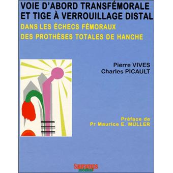 Voie transfemorale et tige a verrouillage distal dans les echecs femoraux des pt