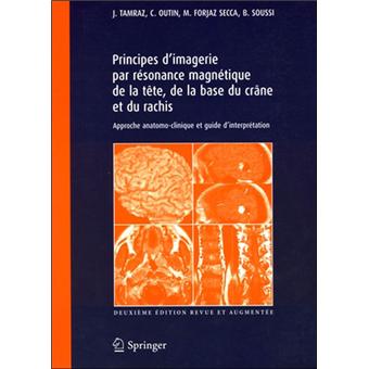 Principes d'imagerie par résonance magnétique de la tête