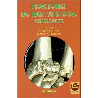 Fractures du radius distal de l adulte