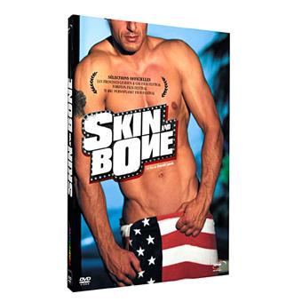 Skin and bone - 1