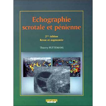 Echographie scrotale et penienne