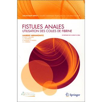 Fistules anales