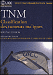 TNM Classification des tumeurs malignes