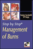Step by step management of burns