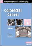 Colorectal cancer