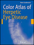 Color atlas of herpetic eye disease