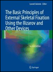 The Basic Principles of External Skeletal Fixation Using the Ilizarov and Other Devices