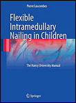 Flexible intramedullary nailing in children