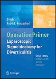 Laparoscopic sigmoidectomy for diverticulitis