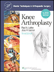 Knee arthroplasty