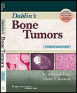 Dahlin's bone tumors