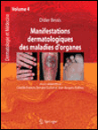 Manifestations dermatologiques des maladies d'organes