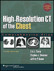 High-resolution ct of the chest