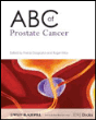 ABC of Prostate Cancer Poche - ABC Of Prostate Cancer 