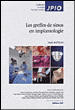 Les greffes de sinus en implantologie