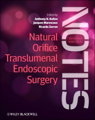 Natural orifice translumenal endoscopic surgery