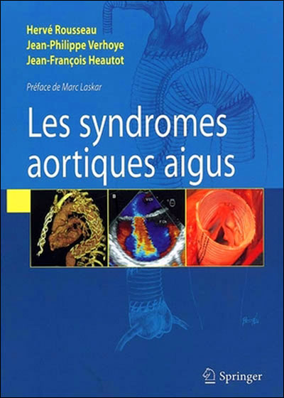 Syndrômes aortiques aigus