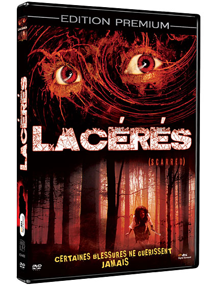 Lacérés