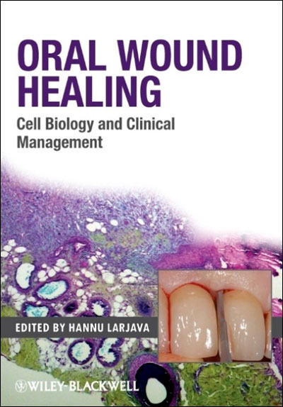 Oral wound healing