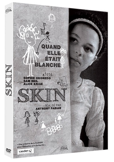 SKIN-VO ST FR