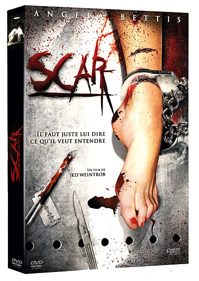 Scar