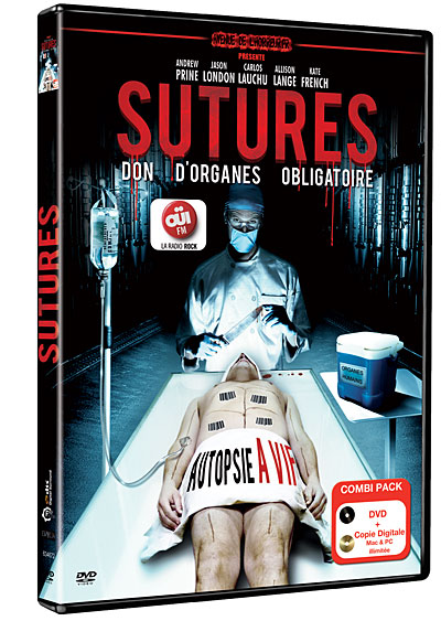 Sutures